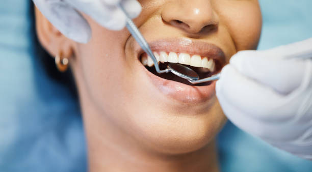 Best Emergency Dental Services for Seniors in Rapid Valley, SD